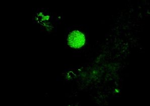 NmV (Nitrosococcus mobilis linneage)