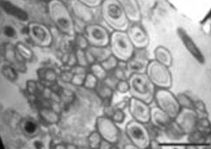 Nitrifiers inside cysts