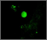  NmV (Nitrosococcusmobilislinneage)