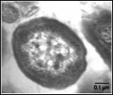 Autotrophic Nitrifiers