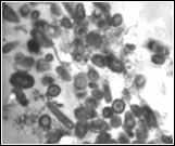 Nitrifiers inside cysts