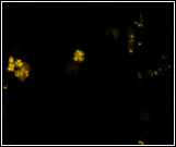  NSO 190 (β Ammonia Oxidizers)